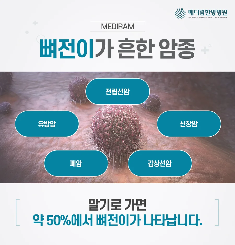 전립선암, 유방암, 폐암, 갑상선암, 신장암처럼 뼈 전이가 흔한 암 종류를 정리한 메디람한방병원 제작 이미지