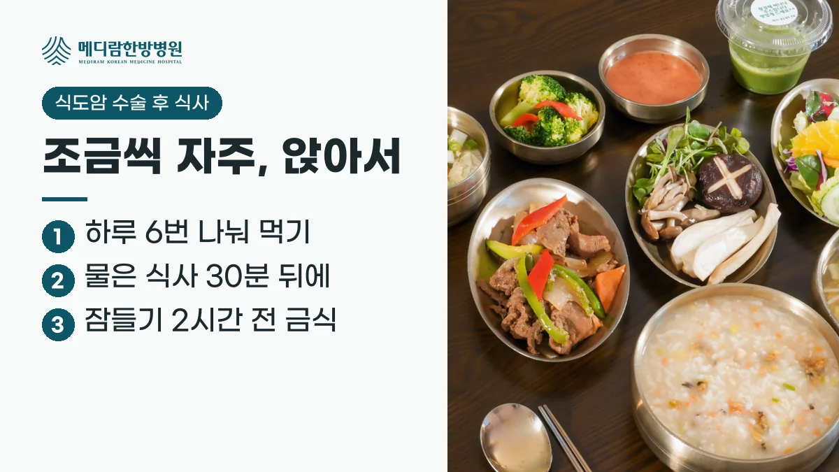 식도암 수술 후 식사 요약: 하루 6번 나눠 먹고, 물은 식사와 30분 이상 떼어 마시며, 잠들기 2시간 전에는 먹지 않는다는 정리 이미지