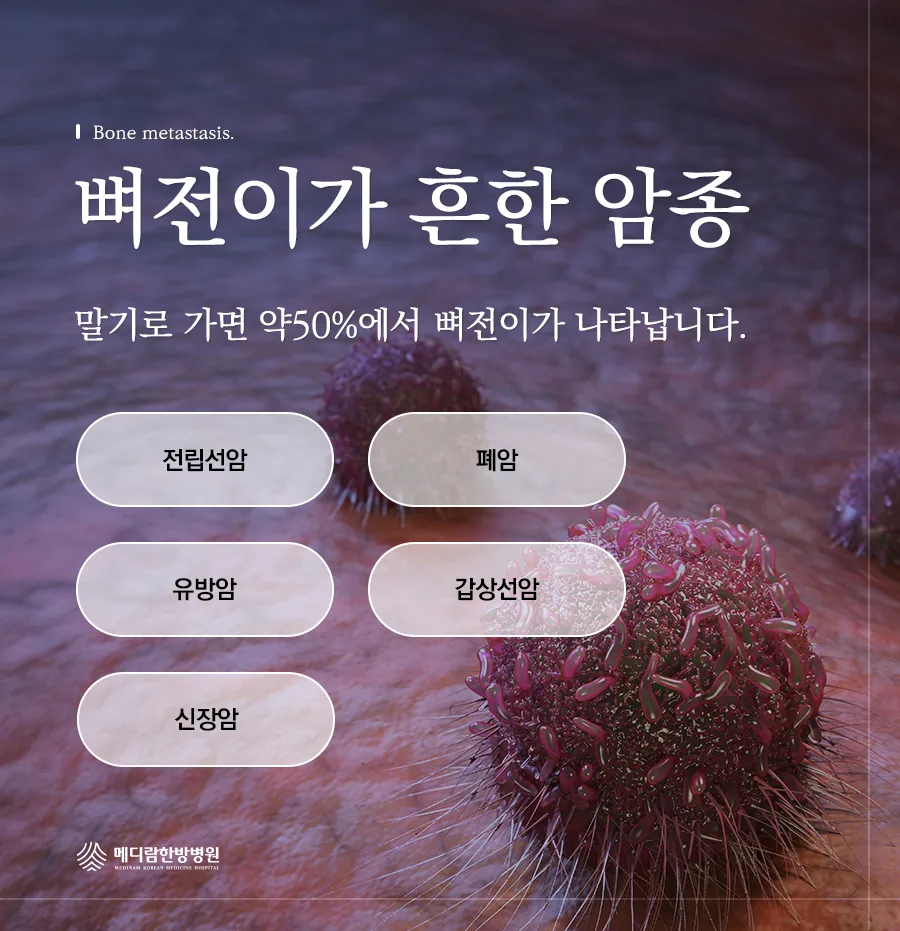 폐암을 포함해 뼈전이가 비교적 흔하게 나타나는 암종을 정리한 병원 자료